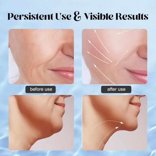 🌟 Face Lifting & EMS Facial Massager – Microcurrent + LED Red Light Therapy | Anti-Wrinkle Skin Tightening Device