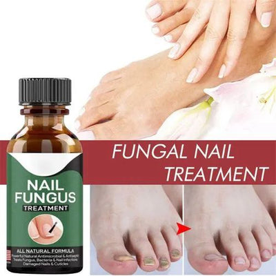 Fast Nail Fungal Treatment Repair Serum | Anti-Fungus | Nail Repair Essence - Mayari Super Store